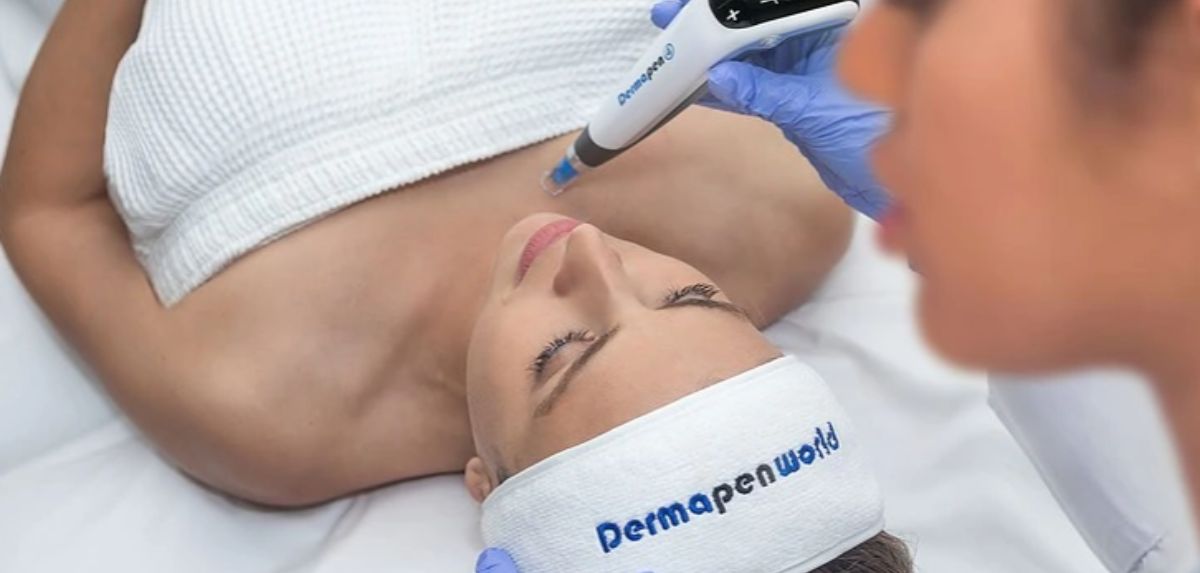 dermapen